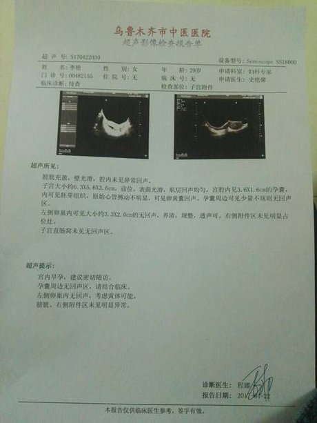 怀孕两个月胎儿发育不好,医生说可能停胎,怎么