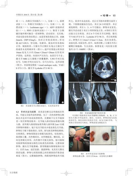 李宏元-杨渝平-关节镜联合小切口技术切开治疗膝关节内罕见腱鞘巨细胞