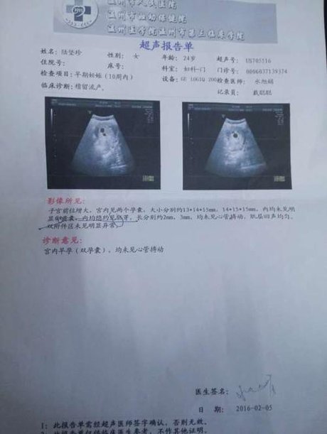 怀孕2个月双胞胎b超图