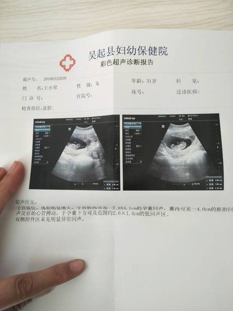 发三个月时b超图帮你看男孩女孩