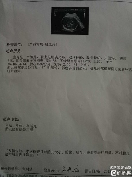 36周胎儿发育标准