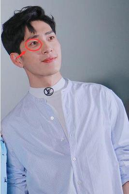 为什么我的眼袋会肿起来 360图片