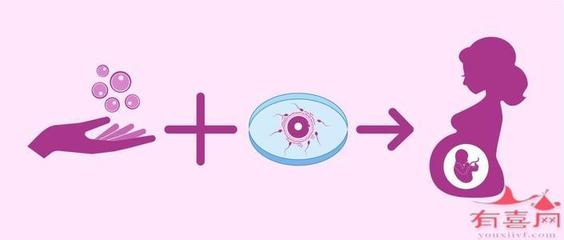 体外怀孕是什么意思