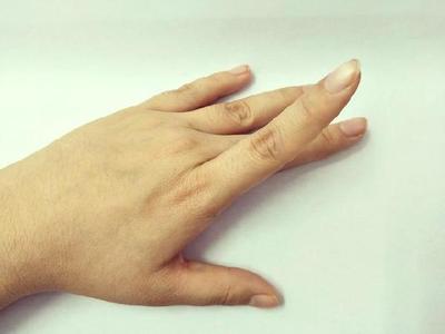 大手指关节痛怎么办