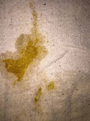 宝宝的便便有酸臭味