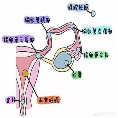 怀孕为什么出血