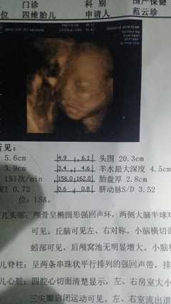 胎儿22周图片