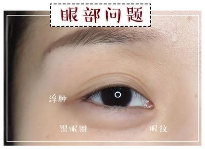 全切双眼皮照片
