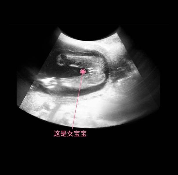 胎儿17周图片