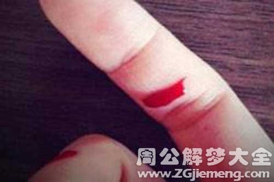 梦见自己手指流血