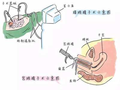 内膜增厚怎么治疗好