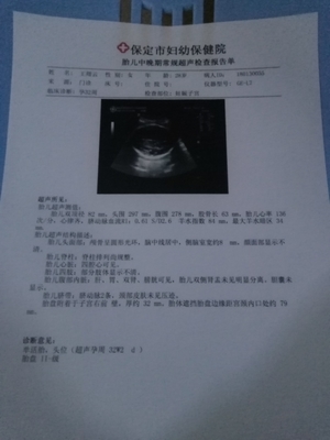 32周胎儿