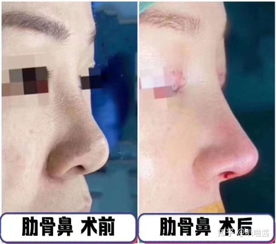 重庆隆鼻一流星宸