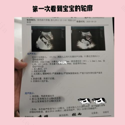 怀孕四十五天有什么反应