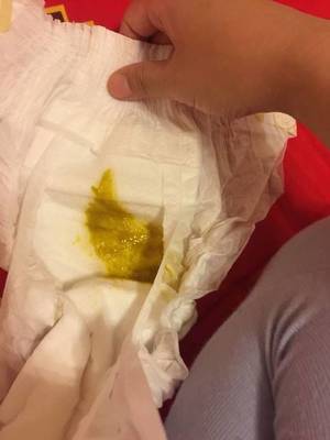 吃了就拉稀是怎么回事