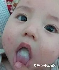 宝宝老是打饱嗝积食吗