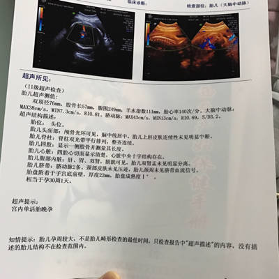 孕32周出血是怎么回事