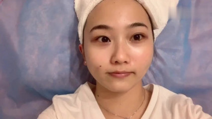 哪里可以买到瘦脸针