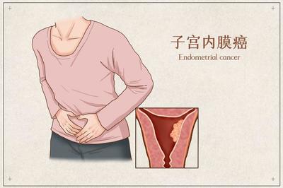 内膜增厚怎么治疗好