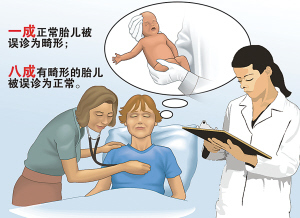 胎儿体重评估