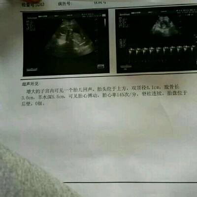 怀孕四个半月胎儿有多大