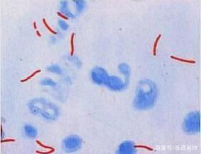 痰是灰色的怎么回事