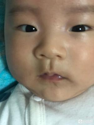 脸发白是怎么回事