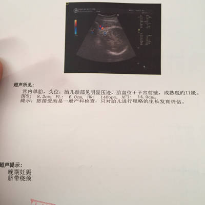 胎儿头位是入盆了吗