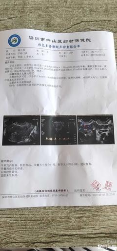怀孕45天有什么症状