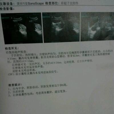 怀孕恶心不吐是男孩吗