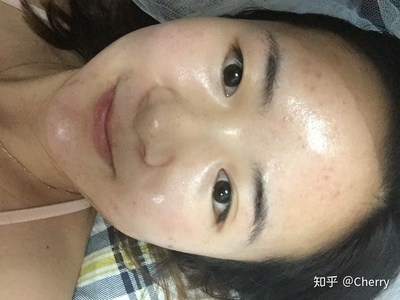 祛痘痕的护肤品哪个好