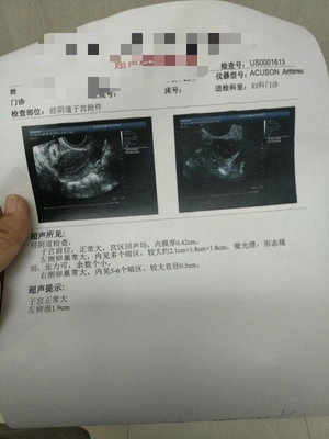 卵泡多大容易怀孕