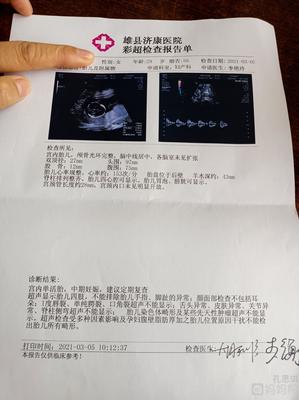彩超 怀孕