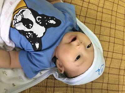 五个月宝宝一周不拉屎怎么办