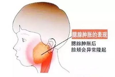 嗓子一侧疼是怎么回事