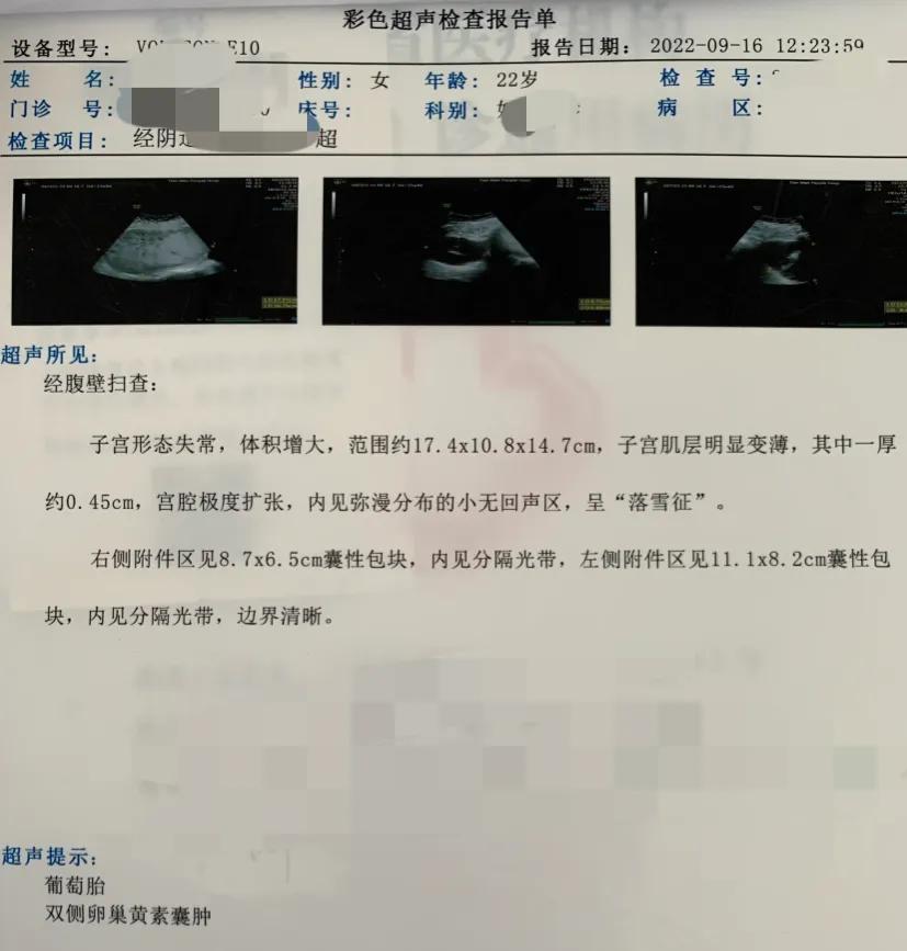 怀孕一个月内会出血吗