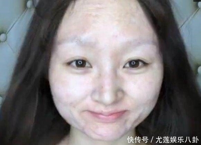 脸抖动是怎么回事
