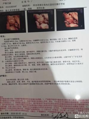 胎儿胎位什么时候固定