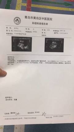 怀孕14周宝宝有多大