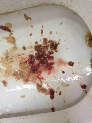 怀孕了吐血怎么回事