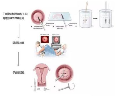 宫颈肿瘤怎么治疗