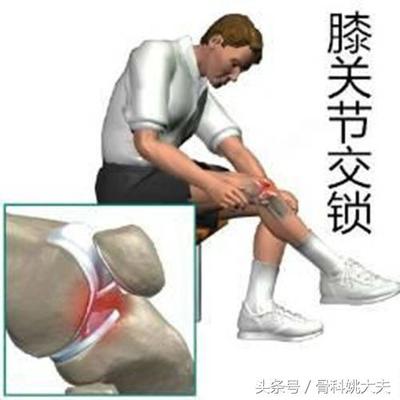 膝关节酸痛怎么治疗