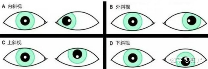看东西有重影是怎么回事