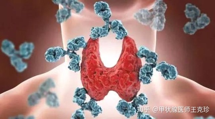 甲状腺炎可以怀孕吗