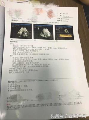怀孕七个月能打胎吗