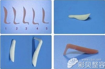 假体隆鼻恢复过程