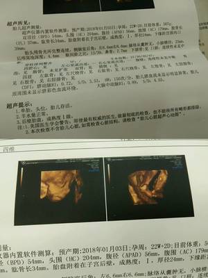 胎儿22周图片