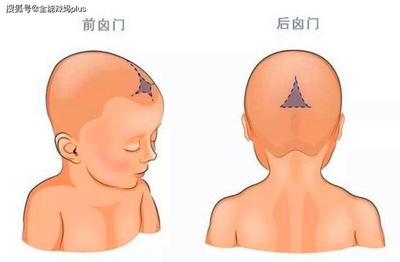 新生儿前卤门大小标准