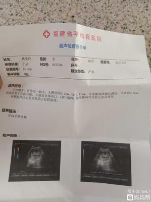 胎盘后壁几个月显怀