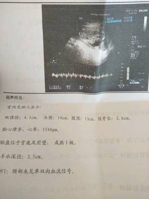 怀孕心率多少算正常